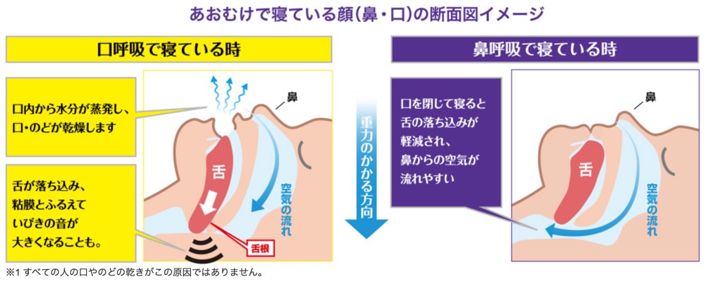 いびき防止グッズを色々検証!効果があったのはこれだ! | ナルポッド いびき防止グッズを色々検証!効果があったのはこれだ! | ナルポッド